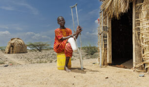 “Como si me comiera desde dentro”: la enfermedad que ataca los huesos en el norte de Kenia
